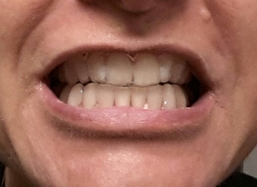 20141204_184926-1.jpg image