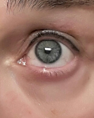 20160203_214050-1-1.jpg image